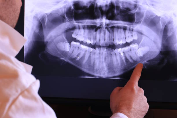 Best Emergency Gum Treatment in Emerald Isle, NC