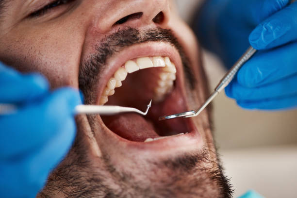 Best Urgent Care for Lost Fillings or Crowns in Emerald Isle, NC